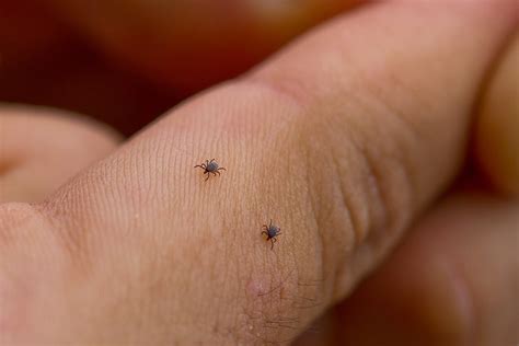 How To Identify And Treat Mite Bites? - Bullfrag