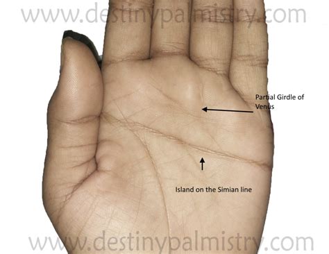 Double Simian or One Simian Line on the Palm - Destiny Palmistry