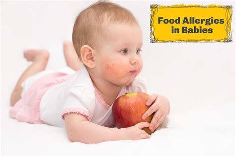 Food Allergies in Babies- Signs, Preventive Measures and Treatment - Being The Parent