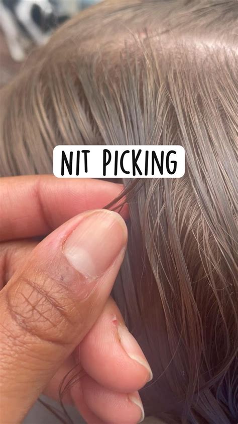 Nit Picking: Lice Removal | Lice removal, Nits, Rings for men