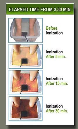 How does an ionic detox foot bath work? : RELIEF SCIENTISTS