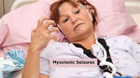 What Causes Myoclonic Seizures? Find Out Here