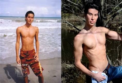 Justin Jedlica: human Ken doll Had 128 plastic surgeries – eCanadaNow