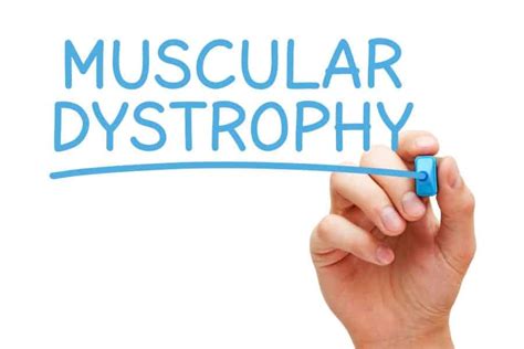 Researchers Discover New Form of Muscular Dystrophy - Rehab Management