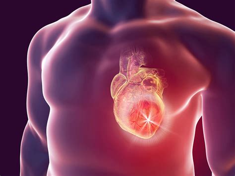 Mesoblast’s Revascor fails to meet primary endpoint in phase III chronic heart failure trial ...