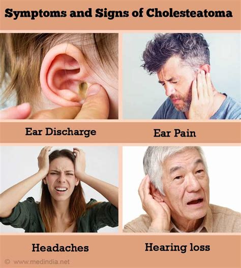 Symptoms and Signs of Cholesteatoma