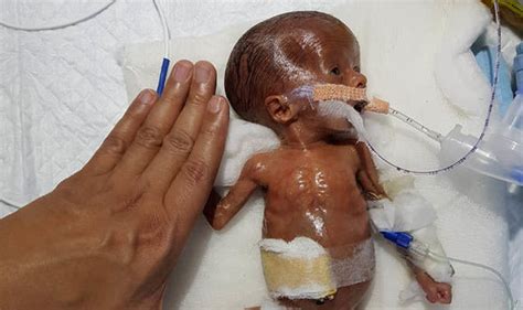 medісаɩ Marvel: Baby Born 14 Weeks Prematurely Thrives After Becoming One of the World’s ...