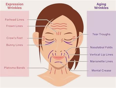 Bunny Lines Botox | Wrinkles Beside The Nose | Dr Majid Shah