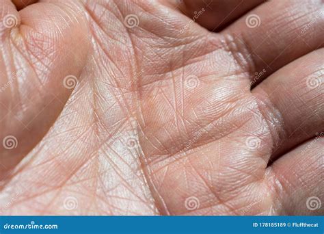 Close-Up of a Man`s Left Hand Showing Palm Skin, Lines and Pattern ...