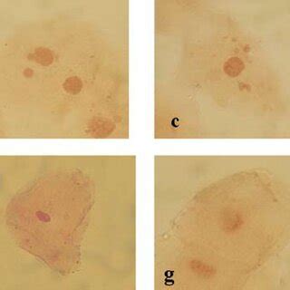 Schematic diagram of different types of buccal cells and the possible... | Download Scientific ...