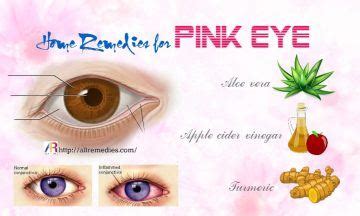 27 at Home Remedies for Pink Eye in Adults