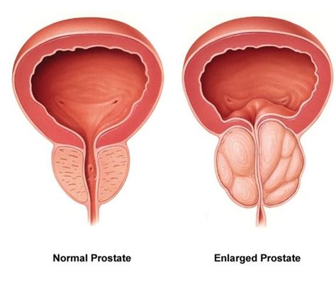 What Happens When A Dog Has An Enlarged Prostate