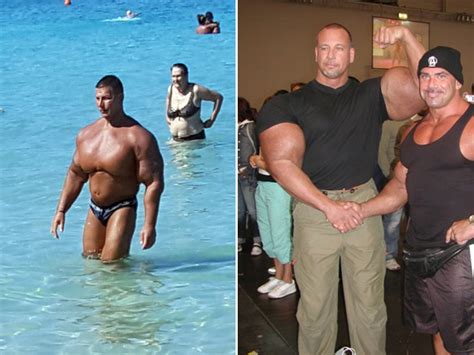 Synthol Freaks: The Most Hated People In Bodybuilding