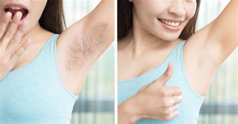 Most women are driven by the desire of having a permanent underarm hair removal treatment by ...