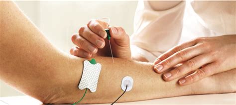 Ambu Neuroline EMG Needle - SMIT Medical