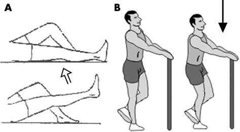 Open versus closed kinetic chain exercises for patellar chondromalacia ...