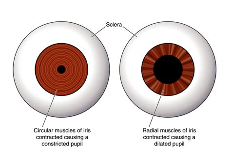 pupil Archives - Discovery Eye Foundation