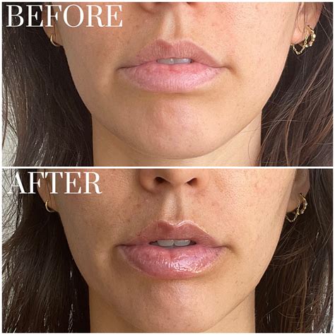 Rhode Peptide Lip Treatment Review With Photos | POPSUGAR Beauty