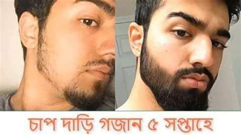 Kirkland Minoxidil Beard Before And After Between my brothers we both ...