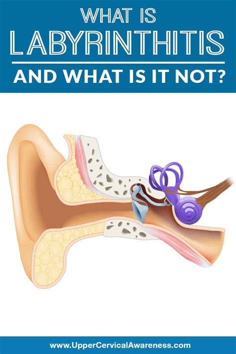What Is Labyrinthitis (and What Is It Not)? - Upper Cervical Awareness
