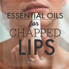 Essential Oils for Chapped Lips - Dry Lips, Be Gone! | Dry lips ...
