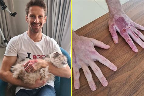 Grosjean - Marion Grosjean Praises Superhero Husband Thanks Rescuers ...