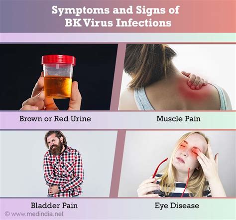 BK Virus Infection - Risk Factors, Symptoms, Signs, Diagnosis ...