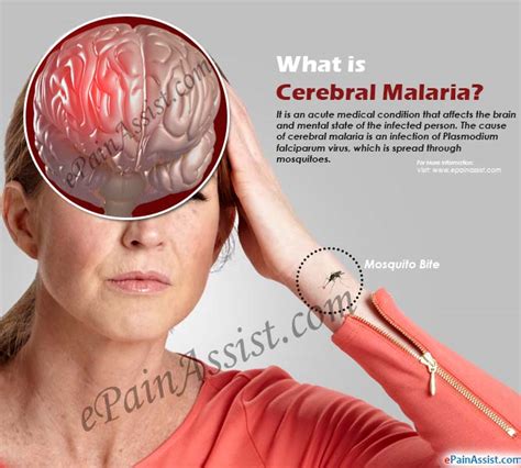 EndMalariaInNigeria: Have you heard of Cerebral Malaria & How is it ...