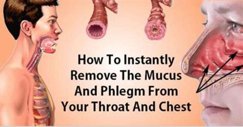 How To Eliminate Mucus And Phlegm From Your Throat And Chest (Instant Result) | Getting rid of ...