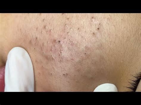 ANOTHER classic from Sac Dep Spa! They are on a roll! : r/popping