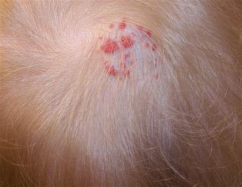 I Have Itchy Bumps On Scalp In 2021 Itchy Bumps Itchy Scalps | Images and Photos finder