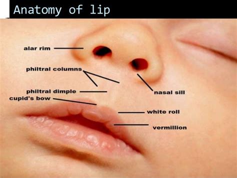 Embryology And Causes Of Cleft Cleft Lip And Palate C - vrogue.co