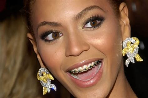 Did Beyonce Have Braces? - The Truth + Proof! - Braces Journey