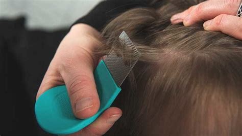 How To Clean Head Lice - Ademploy19