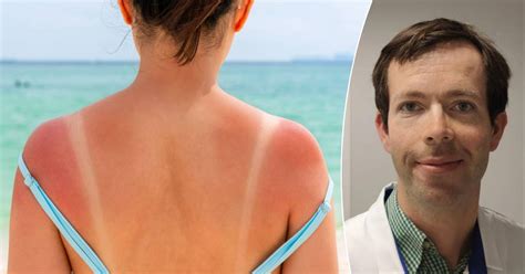The Long-Term Effects of Sunburn: Can Past Sun Damage Lead to Skin ...