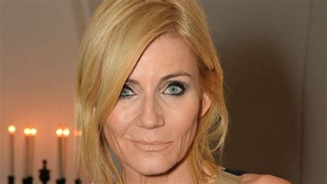 Michelle Collins Plastic Surgery: The Cindy Beale Actress Hates Surgery?