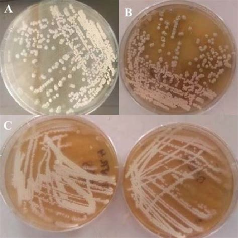 Antibiotic susceptibility of the isolated actinomycetes. | Download ...