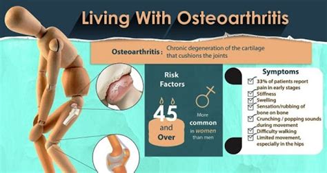 6 Home Remedies for Osteoarthritis