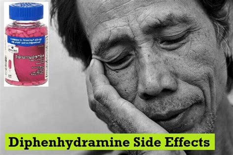 11 Diphenhydramine Side Effects, Rules Of Use, And Dosage