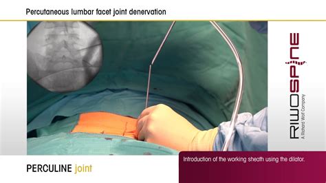 PERCULINE joint - interventional percutaneous facet joint denervation - YouTube