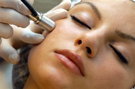 What Is a Microdermabrasion Facial? - Dermatology Center of Acadiana