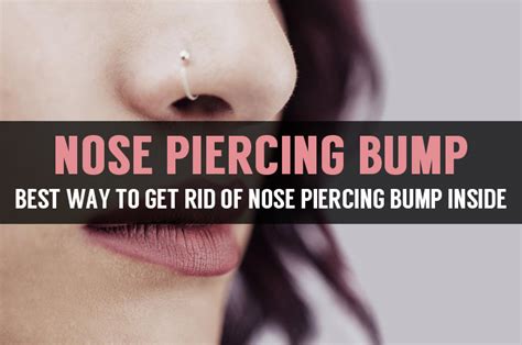 Learn About Nose Piercing Bump Inside and Home Treatment