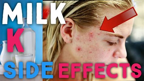 Watch this before drinking milk.| Side effects of milk. - YouTube