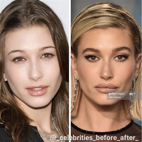 Hailey Bieber | How to make hair, Rhinoplasty nose jobs, Celebrity plastic surgery