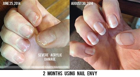 Aggregate more than 129 opi nail envy nail strengthener best - ceg.edu.vn