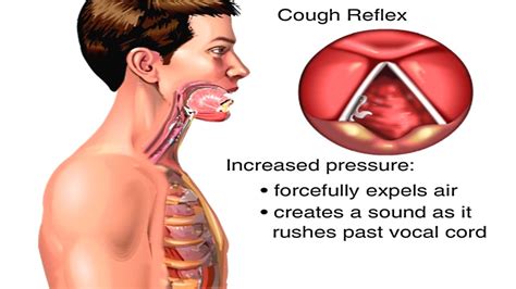 Cough Receptors - Herbs and Food Recipes