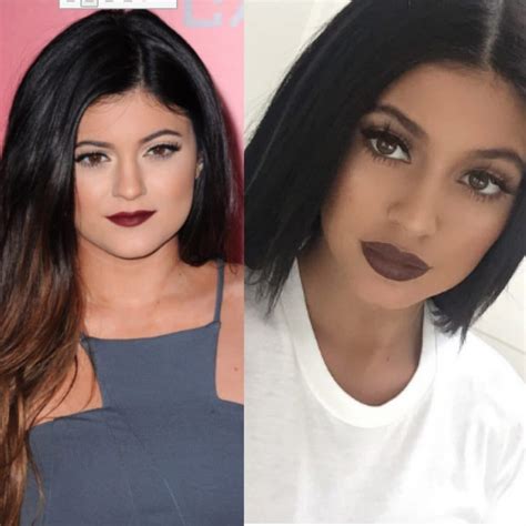 Kylie Jenner Lips Before And After