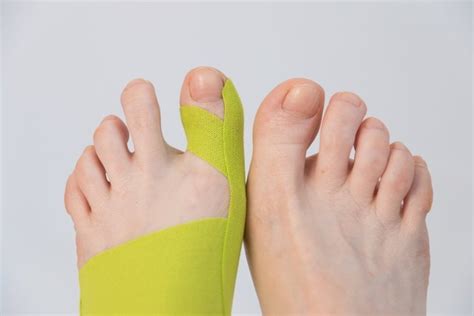 How to Tape for a 5th Metatarsal Fracture - Fortunate Feet