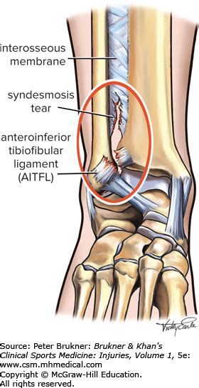 Ankle Syndesmosis Anatomy - Anatomy Reading Source