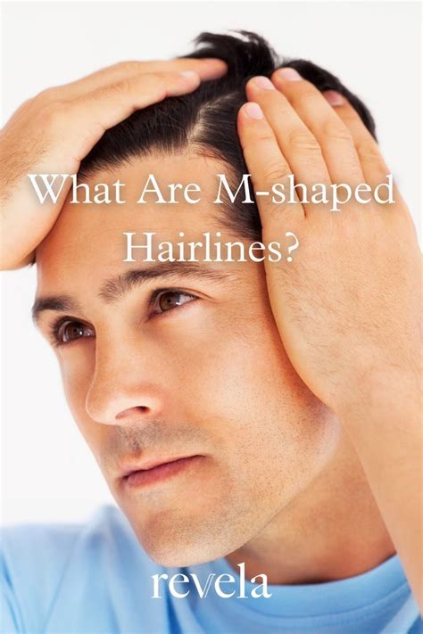 What are M-shaped Hairlines? in 2022 | Receding hair styles, Hairline ...